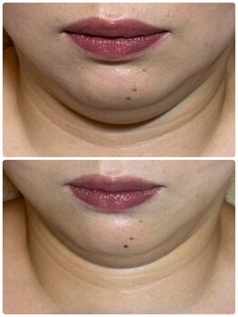 フィフ(fif)/レモンボトルで二重あご撃退！