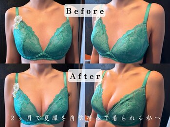 エステティックサロン パヒューム(Esthetic Salon Perfume)/¥ 彼氏に喜ばれる程の変化! /