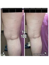 ビユ 大泉店(BIYU)/レッドショット