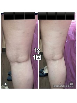 ビユ 大泉店(BIYU)/レッドショット