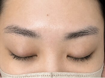 シェリー(Cherie)/before