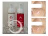 【低刺激ケア】REVI陶器ピール+毛穴吸引付き¥11000