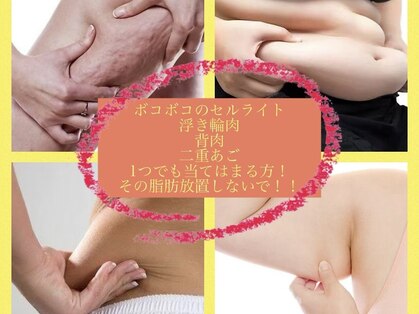本格ダイエット×リンパマッサージ×小顔YOSAPARK SHIRO新札幌本店【ヨサパークシロ】の写真