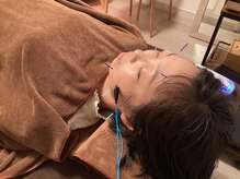 ハリファ鍼灸院 横浜関内院(HariFa鍼灸院)/美容鍼