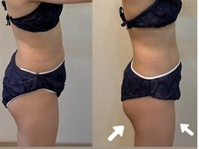 ヨサパーク ルポ(YOSA PARK ropos)/見た目が変わる