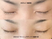 ナル(null)/ラッシュアディクトサロンケア