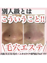 アルムダアクア 天王寺店(Aleumda AQUA)/毛穴エクストラクションプロ大阪