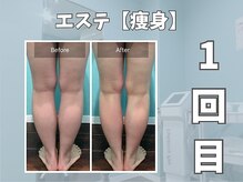 エックス(X)/【痩身】美脚効果◎