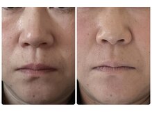 ヨサ パーク コアハート(YOSA PARK CORE HEART)/毎日ルルオン