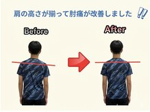 のなか整体院/整体 Before→After
