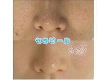 アリム(alim)の雰囲気（セラピールビフォーアフター）