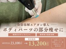 ミロク(369)の雰囲気（強力脂肪分解成分エアガン導入で二の腕や膝肉を◎）