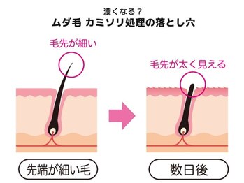 ロミオワックス ジュリエットワックス 新宿店(ROMEO Wax Juliet Wax)/カミソリ処理の落とし穴