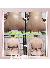 オアシス(OASIS)/上半身痩身かっさ