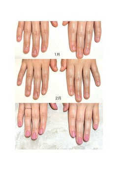 リンク(LINK)/お爪の変化