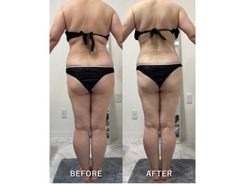 ナルシス/【痩身】12回の変化です★