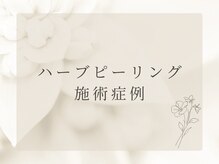 リュクス  Luxe＋tkm 南船場/ハーブピーリング