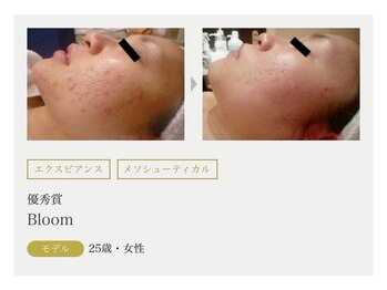 まりも化粧品店/ホワイトスノーピール