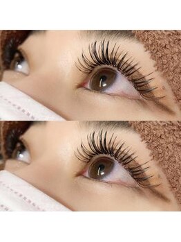 ブロッサ(Blossa)/フラットラッシュ180本