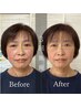 【顔のむくみ、歪み】頭・顔調整+首肩ほぐし+姿勢矯正 60分 ¥3.980