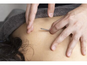 東垣鍼院の写真/【住宅街に佇む大人の隠れ家-。】半個室の贅沢空間で、木の温もりに包まれて♪疲れを手放す休息の時間を。