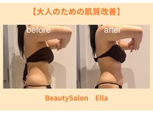 エラ(Ella)