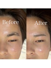 メンズアイブロウサロンバイクロト 天神大名(MEN’S EYEBROW SALON by KUROT)/メンズ眉毛/メンズメイク