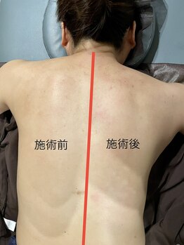 キュア(cure)の写真/その肩こり、その腰の重さ。連休中に頑張ってきた身体を根本リセット！