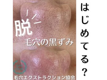 アイシェリー(eyecherie)/毛穴エクストラクション