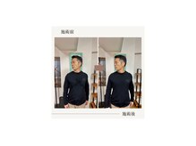 バレルメディカル研究所 恵比寿/しつこい腰痛と首痛。