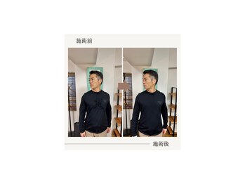 バレルメディカル研究所 恵比寿/しつこい腰痛と首痛。