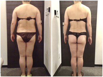 ウェリナ平和堂長久手院/小顔矯正/骨盤矯正/美脚サロン