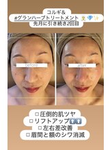 パル コルギサロン(Pal. Korugi salon)/コルギ＆ハーブトリートメント