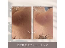 プレジール(Plaisir)