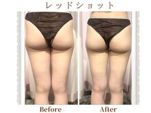モテスリム/レッドショット