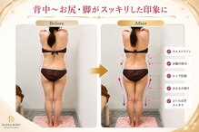 ラディア ボディ(Radia Body)
