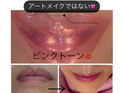 トータルエステ ユキ(YUKI)の写真