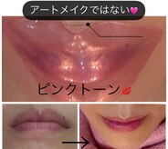 トータルエステ ユキ(YUKI)