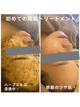 ヴィオナス(Veonus)/初めての陶肌トリートメント