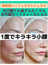 スペチアーレ 夙川/美顔と小顔を同時にGET