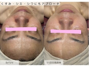 サロンベース(salon BASE)/くすみ・シミ・シワにアプローチ