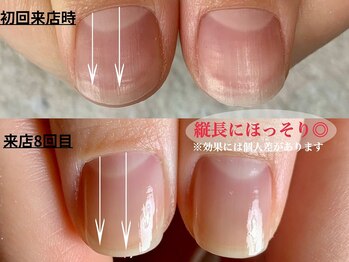ネイルケアで自爪育成♪