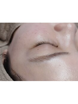 顔脱毛がしたい