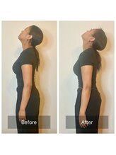 ルポアミ 代々木上原(REPOS AMI)/クラニオヘッドスパ　１回の変化