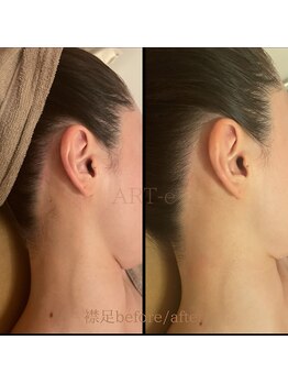 アルテ(ART-e)/Before/Afterプレ花嫁様1day