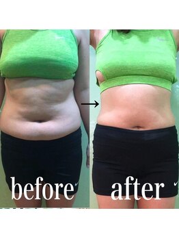 スパチャーレ(Spa ciare)/【トーンヌール】before&after