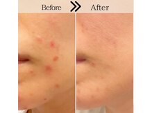 スリリアン 銀座/★お客さまビフォーアフター★