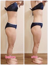 リナル 祐天寺店/150分☆痩身マシン＋全身リンパ