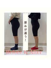 スタイルラボ高松/産後の骨盤矯正の効果♪