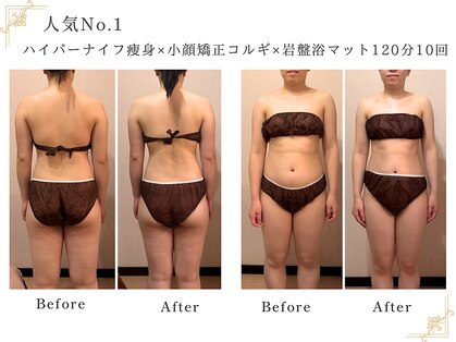ミネット(Minett)の写真